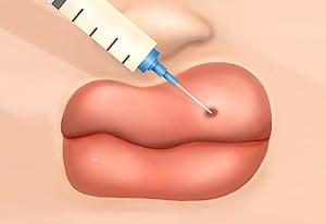 Jogos de Cirurgia